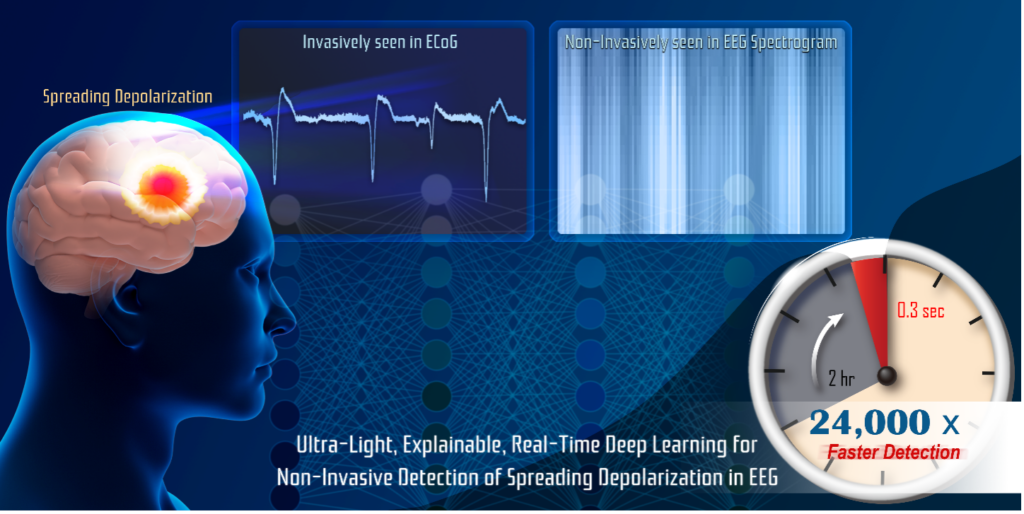 Real-Time Non-Invasive Imaging and Detection of Spreading Depolarizations through EEG: An Ultra-Light Explainable Deep Learning Approach