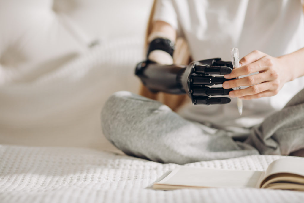 Artificial arms for restoring hand function. a, A prosthetic arm