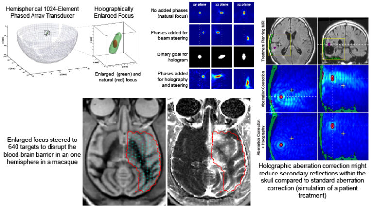 Non-invasive Blood-Brain Barrier Disruption using Acoustic Holography with a Clinical Focused Ultrasound System