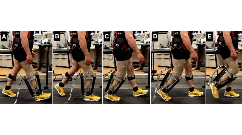 Locomotor Adaptation By Transtibial Amputees Walking With An Experimental Powered Prosthesis