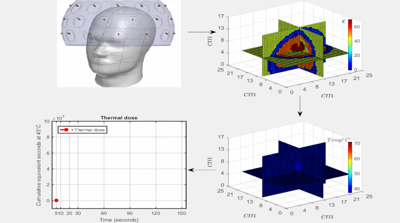Real-Time 3D Microwave Monitoring of Interstitial Thermal Therapy ...